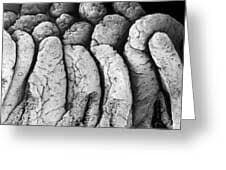 Villi Of The Small Intestine #2 Photograph by Dennis Kunkel Microscopy / Science Photo Library - Fine Art America