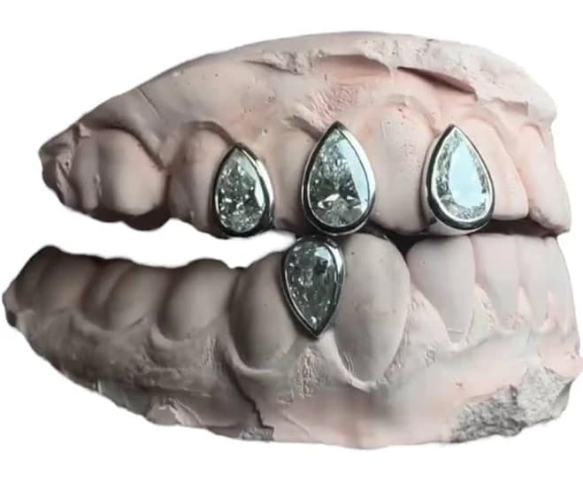 Custom Pear-Cut Diamond Grillz