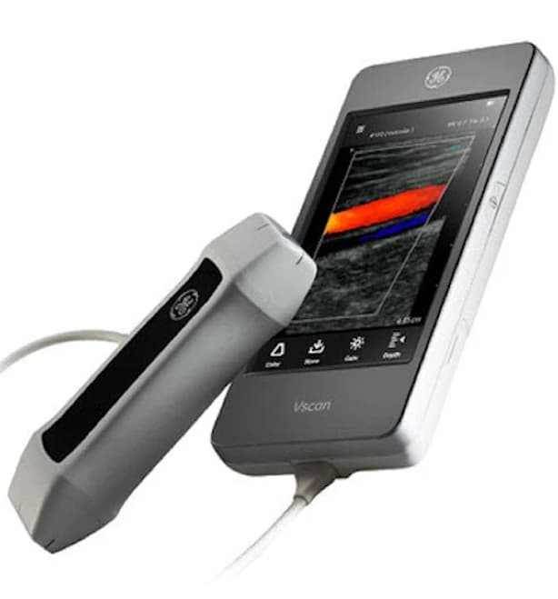 GE - Vscan Sale