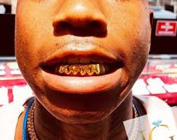6 Teeth (rose, Yellow, White Color Choices) - Etsy