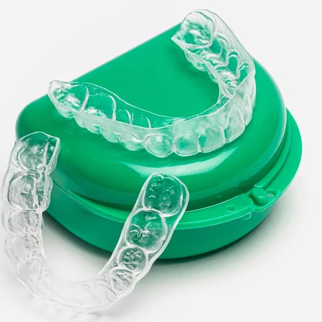 ClearRetain Bleaching Tray Retainers