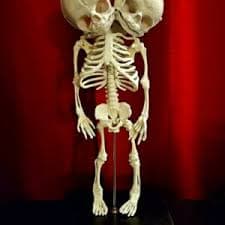 2 Headed Fetal Skeleton, Human Fetus Skeleton, Conjoined Twins Skeleton, Anatomical Skeleton - Oddities For Sale has unique