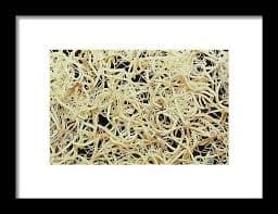 Clump Of The Whipworm Trichuris Trichiura Framed Print by Sinclair Stammers / Science Photo Library - Fine Art America