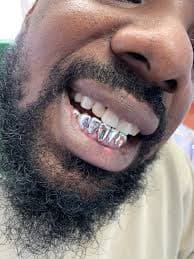 Silver Grillz ($65 Per Tooth)