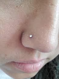 extra skin around nose piercing