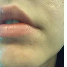 Flexible Labret Retainer