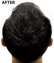 Super Million Hair - 15g Hair Fibres - No.45 Medium Blonde | Buy Now with Express International Delivery | GoSupps.com