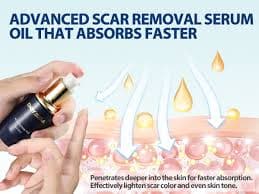 Amazon.com : Boysea Scar Cream & Serum Oil, Advanced Scar Removal Set, Reduces Appearance of Keloids, C-Sections, Surgeries, Burns, Acne, 2 x 1.06 Oz Bottles : Health & Household