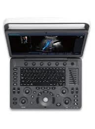 SonoScape Ultrasound Machines and Medical Imaging Equipment
