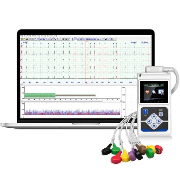 12-Lead Holter Monitor