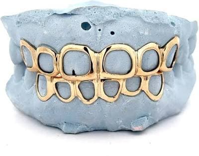 Custom Open Face Gold Grillz Gold Top Bottom