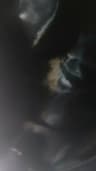 Video frame trigger