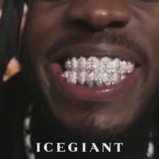 VVS Diamonds Grillz – Big Pointer Set | TheIGT – ICEGIANT