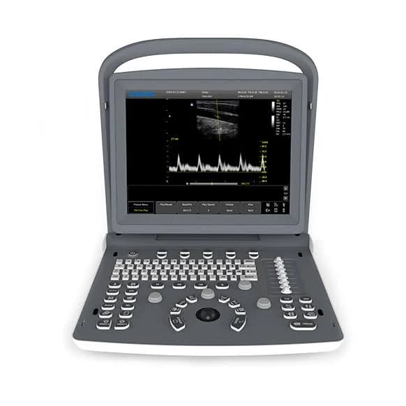 Imaging Associates Chison Eco2 Ultrasound System