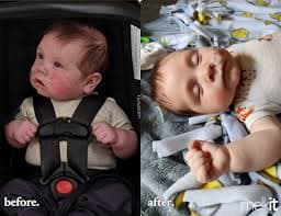 Bébé Melk – Melkit