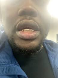 gold grillz 10k | eBay