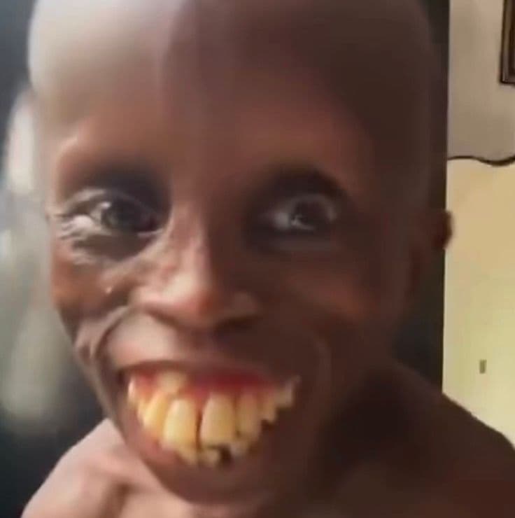 Maxpain